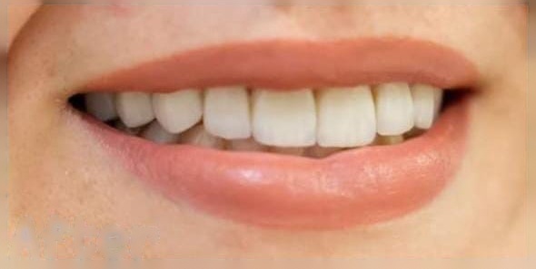 Oral Surgery after